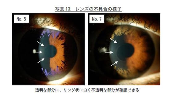 レンズの不具合の様子