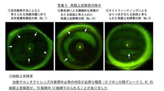 角膜上皮障害の様子